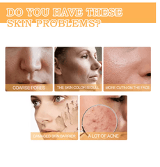 Eelhoe - Glycolic Acid 7% Toning Solution - Beauty Blushh